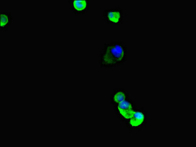 TUBB4 / Tubulin Beta 4 Antibody - Immunofluorescent analysis of MCF7 cells diluted at 1:100 and Alexa Fluor 488-congugated AffiniPure Goat Anti-Rabbit IgG(H+L)