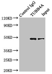 TUBB4 / Tubulin Beta 4 Antibody - Immunoprecipitating TUBB4A in Hela whole cell lysate Lane 1: Rabbit monoclonal IgG (1µg) instead of product in Hela whole cell lysate.For western blotting,a HRP-conjugated Protein G antibody was used as the Secondary antibody (1/2000) Lane 2: product (8µg) + Hela whole cell lysate (500µg) Lane 3: Hela whole cell lysate (10µg)