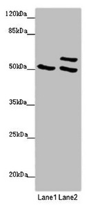 TUBB4 / Tubulin Beta 4 Antibody - Western blot All Lanes :TUBB4A antibody at 2 ug/ml Lane 1 : 293T whole cell lysate Lane 2 : Hela whole cell lysate Secondary Goat polyclonal to rabbit IgG at 1/10000 dilution Predicted band size: 50 kDa Observed band size: 50,58 kDa