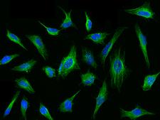 TUBB4 / Tubulin Beta 4 Antibody - Immunofluorescence staining of TUBB4A in Hela cells. Cells were fixed with 4% PFA, permeabilzed with 0.1% Triton X-100 in PBS, blocked with 10% serum, and incubated with rabbit anti-Human TUBB4A polyclonal antibody (dilution ratio 1:1000) at 4°C overnight. Then cells were stained with the Alexa Fluor 488-conjugated Goat Anti-rabbit IgG secondary antibody (green) and counterstained with DAPI (blue). Positive staining was localized to Cytoskeleton.