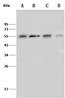 TUBB4 / Tubulin Beta 4 Antibody - Anti-TUBB4A rabbit polyclonal antibody at 1:5000 dilution. Lane A: HeLa Whole Cell Lysate. Lane B: Jurkat Whole Cell Lysate. Lane C: HEK293 Whole Cell Lysate. Lane D: K562 Whole Cell Lysate. Lysates/proteins at 30 ug per lane. Secondary: Goat Anti-Rabbit IgG (H+L)/HRP at 1/10000 dilution. Developed using the ECL technique. Performed under reducing conditions. Predicted band size: 50 kDa. Observed band size: 54 kDa.
