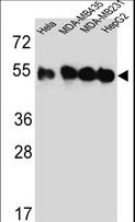 TUBB4B / Tubulin Beta 4B Antibody - Western blot of TUBB2C Antibody in HeLa,MDA-MB435,MDA-MB231,HepG2 cell line lysates (35 ug/lane). TUBB2C (arrow) was detected using the purified antibody.
