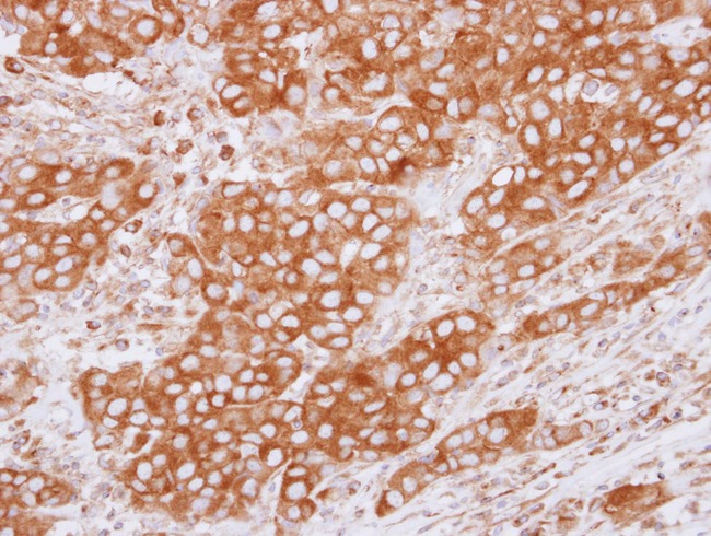 Anti-TUBB4B / Tubulin Beta 4B Antibody | Rabbit anti-Human IHC,WB | LSBio