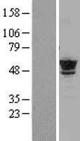 TUBB4B / Tubulin Beta 4B Protein - Western validation with an anti-DDK antibody * L: Control HEK293 lysate R: Over-expression lysate