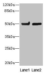 TUBB6 / Tubulin Beta 6 Antibody - Western blot All lanes: TUBB6 antibody at 4µg/ml Lane 1: Hela whole cell lysate Lane 2: MDA-MB-231 whole cell lysate Secondary Goat polyclonal to rabbit IgG at 1/10000 dilution Predicted band size: 50 kDa Observed band size: 50 kDa
