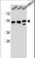 TUBB6 / Tubulin Beta 6 Antibody - TUBB6 Antibody western blot of K562,HeLa,MDA-MB231 cell line lysates (35 ug/lane). The TUBB6 antibody detected the TUBB6 protein (arrow).