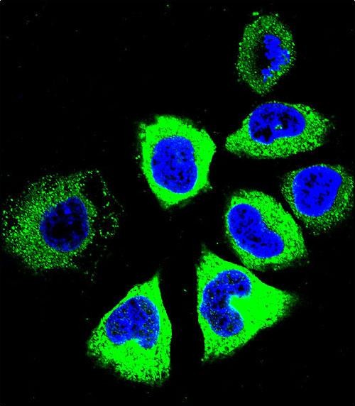 TUBB8P12 / Tubulin beta-8 Antibody - Confocal immunofluorescent analysis of YI016 Antibody (C-term) with NCI-H460 cell followed by Alexa Fluor 488-conjugated goat anti-rabbit lgG (green). DAPI was used to stain the cell nuclear (blue).