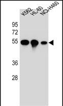 TUBB8P12 / Tubulin beta-8 Antibody - YI016 Antibody (C-term) western blot analysis in K562,HL-60,NCI-H460 cell line lysates (35ug/lane).This demonstrates the YI016 antibody detected the YI016 protein (arrow).