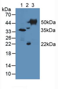 TUBD1 / Tubulin Delta Antibody - Western Blot; Sample: Lane1: Mouse Kidney Tissue; Lane2: Mouse Ovary Tissue; Lane3: Mouse Testis Tissue.