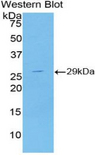 TUBD1 / Tubulin Delta Antibody - Western blot of recombinant TUBD1.  This image was taken for the unconjugated form of this product. Other forms have not been tested.