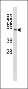 TUBD1 / Tubulin Delta Antibody - TUBD1 Antibody western blot of ZR-75-1 cell line lysates (35 ug/lane). The TUBD1 antibody detected the TUBD1 protein (arrow).