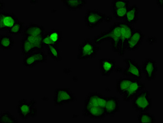 TUBD1 / Tubulin Delta Antibody - Immunofluorescent analysis of MCF-7 cells at a dilution of 1:100 and Alexa Fluor 488-congugated AffiniPure Goat Anti-Rabbit IgG(H+L)