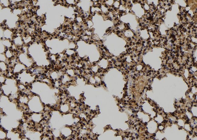TUBD1 / Tubulin Delta Antibody - 1:100 staining mouse lung tissue by IHC-P. The sample was formaldehyde fixed and a heat mediated antigen retrieval step in citrate buffer was performed. The sample was then blocked and incubated with the antibody for 1.5 hours at 22°C. An HRP conjugated goat anti-rabbit antibody was used as the secondary.