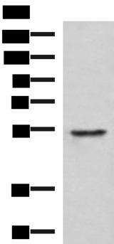 TUBD1 / Tubulin Delta Antibody - Western blot analysis of Jurkat cell lysate  using TUBD1 Polyclonal Antibody at dilution of 1:1000