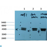 TUBE1 / Tubulin Epsilon Antibody - Western Blot (WB) analysis of 1) MCF7Cell Lysate, 2) Rat Brain Tissue Lysate, 3) Mouse Brain Tissue Lysate using Epsilon Tubulin Mouse Monoclonal Antibody diluted at 1:2000.