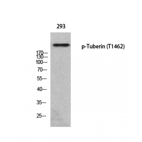 Tuberin / TSC2 Antibody - Western blot of Phospho-Tuberin (T1462) antibody