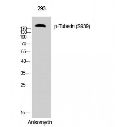 Tuberin / TSC2 Antibody - Western blot of Phospho-Tuberin (S939) antibody