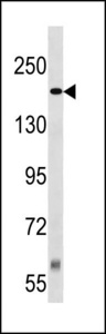 Tuberin / TSC2 Antibody - TSC2 Antibody (Center S1385/S1386) western blot of Jurkat cell line lysates (35 ug/lane). The TSC2 antibody detected the TSC2 protein (arrow).