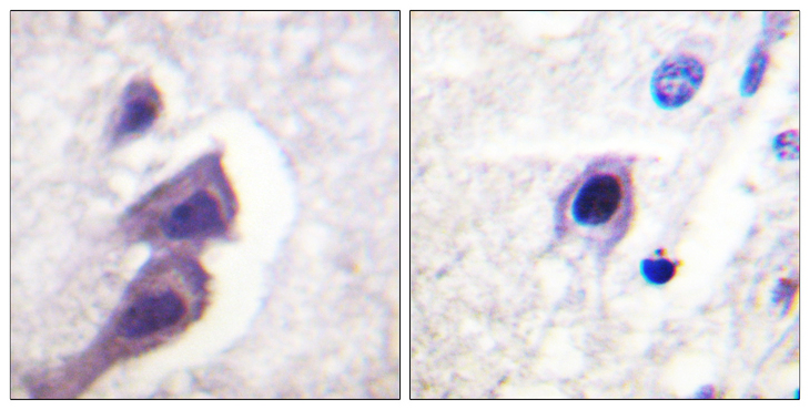 Tuberin / TSC2 Antibody - Immunohistochemistry analysis of paraffin-embedded human brain tissue, using Tuberin/TSC2 Antibody. The picture on the right is blocked with the synthesized peptide.