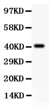 Tuberin / TSC2 Antibody - Tuberin antibody Western blot. All lanes: Anti Tuberin at 0.5 ug/ml. WB: Recombinant Human Tuberin Protein 0.5ng. Predicted band size: 41 kD. Observed band size: 41 kD.