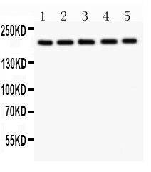 Tuberin / TSC2 Antibody - Tuberin antibody Western blot. All lanes: Anti Tuberin at 0.5 ug/ml. Lane 1: U20S Whole Cell Lysate at 40 ug. Lane 2: PANC Whole Cell Lysate at 40 ug. Lane 3: HEPG2 Whole Cell Lysate at 40 ug. Lane 4: A549 Whole Cell Lysate at 40 ug. Lane 5: COLO320 Whole Cell Lysate at 40 ug . Predicted band size: 201 kD. Observed band size: 201 kD.