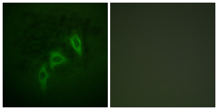 Tuberin / TSC2 Antibody - Immunofluorescence analysis of HepG2 cells, using Tuberin/TSC2 Antibody. The picture on the right is blocked with the synthesized peptide.