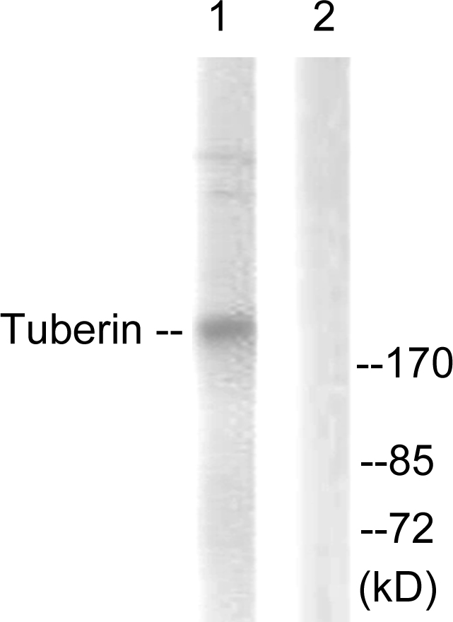 Tuberin / TSC2 Antibody - Western blot analysis of lysates from 293 cells, treated with Anisomycin 25ug/ml 30', using Tuberin/TSC2 Antibody. The lane on the right is blocked with the synthesized peptide.
