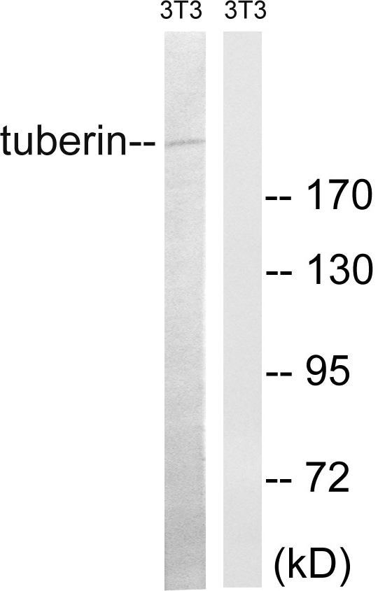 Tuberin / TSC2 Antibody - Western blot analysis of lysates from NIH/3T3 cells, using Tuberin Antibody. The lane on the right is blocked with the synthesized peptide.