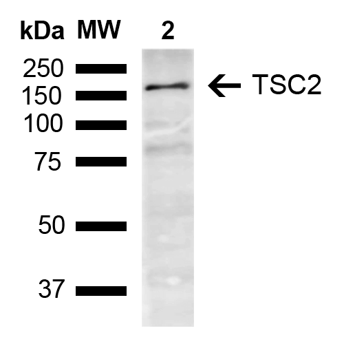 Tuberin / TSC2 Antibody - Western blot analysis of Mouse Brain showing detection of ~200.6 kDa TSC2 protein using Rabbit Anti-TSC2 Polyclonal Antibody. Lane 1: Molecular Weight Ladder (MW). Lane 2: Mouse Brain. Load: 15 µg. Block: 5% Skim Milk in 1X TBST. Primary Antibody: Rabbit Anti-TSC2 Polyclonal Antibody  at 1:1000 for 2 hours at RT. Secondary Antibody: Goat Anti-Rabbit IgG: HRP at 1:3000 for 1 hour at RT. Color Development: ECL solution for 5 min at RT. Predicted/Observed Size: ~200.6 kDa.