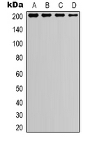 Tuberin / TSC2 Antibody - Western blot analysis of TSC2 expression in A549 (A); HEK293T (B); NIH3T3 (C); mouse kidney (D) whole cell lysates.
