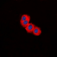 Tuberin / TSC2 Antibody - Immunofluorescent analysis of TSC2 staining in HepG2 cells. Formalin-fixed cells were permeabilized with 0.1% Triton X-100 in TBS for 5-10 minutes and blocked with 3% BSA-PBS for 30 minutes at room temperature. Cells were probed with the primary antibody in 3% BSA-PBS and incubated overnight at 4 deg C in a humidified chamber. Cells were washed with PBST and incubated with a DyLight 594-conjugated secondary antibody (red) in PBS at room temperature in the dark. DAPI was used to stain the cell nuclei (blue).