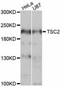 Tuberin / TSC2 Antibody - Western blot analysis of extracts of various cell lines, using TSC2 antibody at 1:1000 dilution. The secondary antibody used was an HRP Goat Anti-Rabbit IgG (H+L) at 1:10000 dilution. Lysates were loaded 25ug per lane and 3% nonfat dry milk in TBST was used for blocking. An ECL Kit was used for detection and the exposure time was 90s.