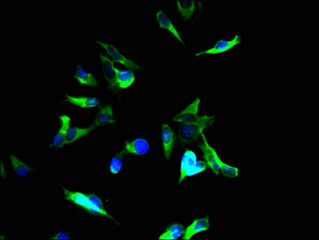 Tuberin / TSC2 Antibody - Immunofluorescent analysis of Hela cells using TSC2 Antibody at a dilution of 1:100 and Alexa Fluor 488-congugated AffiniPure Goat Anti-Rabbit IgG(H+L)