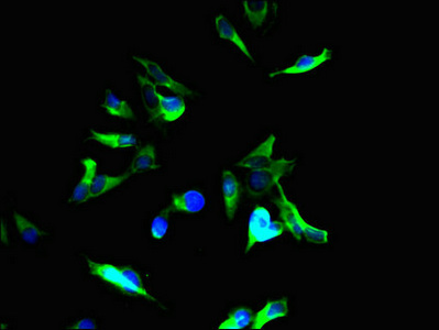 Tuberin / TSC2 Antibody - Immunofluorescent analysis of Hela cells using TSC2 Antibody at dilution of 1:100 and Alexa Fluor 488-congugated AffiniPure Goat Anti-Rabbit IgG(H+L)