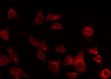 Tuberin / TSC2 Antibody - Staining 293 cells by IF/ICC. The samples were fixed with PFA and permeabilized in 0.1% Triton X-100, then blocked in 10% serum for 45 min at 25°C. The primary antibody was diluted at 1:200 and incubated with the sample for 1 hour at 37°C. An Alexa Fluor 594 conjugated goat anti-rabbit IgG (H+L) Ab, diluted at 1/600, was used as the secondary antibody.