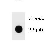 Tuberin / TSC2 Antibody - Dot blot of mouse TSC2 Antibody (Phospho S1096) Phospho-specific antibody on nitrocellulose membrane. 50ng of Phospho-peptide or Non Phospho-peptide per dot were adsorbed. Antibody working concentrations are 0.6ug per ml.