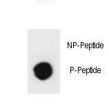 Tuberin / TSC2 Antibody - Dot blot of mouse TSC2 Antibody (Phospho S1343) Phospho-specific antibody on nitrocellulose membrane. 50ng of Phospho-peptide or Non Phospho-peptide per dot were adsorbed. Antibody working concentrations are 0.6ug per ml.