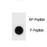 Tuberin / TSC2 Antibody - Dot blot of TSC2 Antibody (Phospho S1388) Phospho-specific antibody on nitrocellulose membrane. 50ng of Phospho-peptide or Non Phospho-peptide per dot were adsorbed. Antibody working concentrations are 0.6ug per ml.