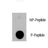 Tuberin / TSC2 Antibody - Dot blot of anti-TSC2-pS1420 Phospho-specific antibody (RB13391) on nitrocellulose membrane. 50ng of Phospho-peptide or Non Phospho-peptide per dot were adsorbed. Antibody working concentrations are 0.5ug per ml.