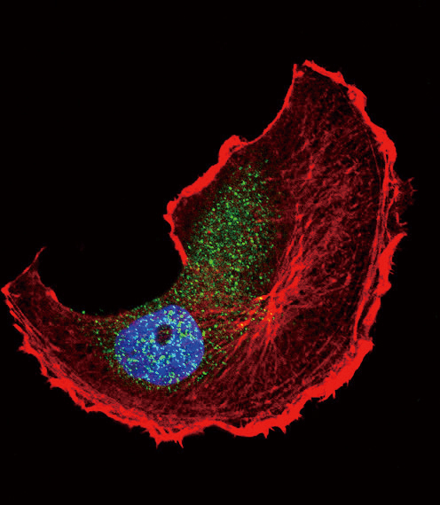 Tuberin / TSC2 Antibody - Confocal immunofluorescence of Phospho-TSC2-S1798 Antibody with MCF-7 cell followed by Alexa Fluor 488-conjugated goat anti-rabbit lgG (green). Actin filaments have been labeled with Alexa Fluor 555 phalloidin (red). DAPI was used to stain the cell nuclear (blue).