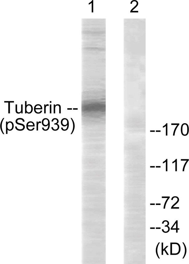 Tuberin / TSC2 Antibody - Western blot analysis of lysates from 293 cells treated with Anisomycin 25ug/ml 30', using Tuberin/TSC2 (Phospho-Ser939) Antibody. The lane on the right is blocked with the phospho peptide.