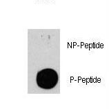 Tuberin / TSC2 Antibody - Dot blot of anti-TSC2-pS939 Phospho-specific antibody on nitrocellulose membrane. 50ng of Phospho-peptide or Non Phospho-peptide per dot were adsorbed. Antibody working concentrations are 0.5ug per ml.