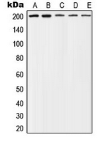 Tuberin / TSC2 Antibody - Western blot analysis of TSC2 (pT1462) expression in SHSY5Y (A); PC3 (B); LNCaP (C); NIH3T3 (D); PC12 (E) whole cell lysates.