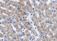 Tuberin / TSC2 Antibody - 1:100 staining human liver tissue by IHC-P. The tissue was formaldehyde fixed and a heat mediated antigen retrieval step in citrate buffer was performed. The tissue was then blocked and incubated with the antibody for 1.5 hours at 22°C. An HRP conjugated goat anti-rabbit antibody was used as the secondary.