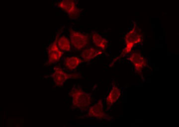 Tuberin / TSC2 Antibody - Staining 293 cells by IF/ICC. The samples were fixed with PFA and permeabilized in 0.1% Triton X-100, then blocked in 10% serum for 45 min at 25°C. The primary antibody was diluted at 1:200 and incubated with the sample for 1 hour at 37°C. An Alexa Fluor 594 conjugated goat anti-rabbit IgG (H+L) Ab, diluted at 1/600, was used as the secondary antibody.