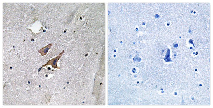 Tuberin / TSC2 Antibody - Immunohistochemistry analysis of paraffin-embedded human brain, using TSC2 (Phospho-Tyr1571) Antibody. The picture on the right is blocked with the phospho peptide.