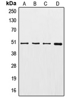 TUBG1 / Tubulin Gamma 1 Antibody - Western blot analysis of Gamma-tubulin expression in A549 (A); HeLa (B); HEK293T (C); NIH3T3 (D) whole cell lysates.