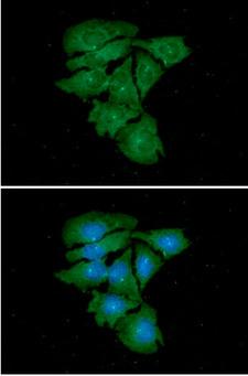 TUBG1 / Tubulin Gamma 1 Antibody - ICC/IF analysis of TUBG1 in HeLa cells. The cell was stained with TUBG1 antibody (1:100).The secondary antibody (green) was used Alexa Fluor 488. DAPI was stained the cell nucleus (blue).