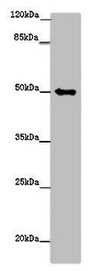 TUBG1 / Tubulin Gamma 1 Antibody - Western blot All Lanes: TUBG1 antibody at 14 ug/ml+ Hela whole cell lysate Secondary Goat polyclonal to rabbit IgG at 1/10000 dilution Predicted band size: 51 kDa Observed band size: 51 kDa