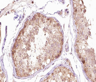 TUBG1 / Tubulin Gamma 1 Antibody - 1:100 staining human Testis tissue by IHC-P. The tissue was formaldehyde fixed and a heat mediated antigen retrieval step in citrate buffer was performed. The tissue was then blocked and incubated with the antibody for 1.5 hours at 22°C. An HRP conjugated goat anti-rabbit antibody was used as the secondary.